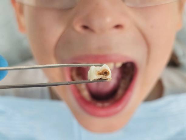 Best Emergency Gum Treatment in Katonah, NY